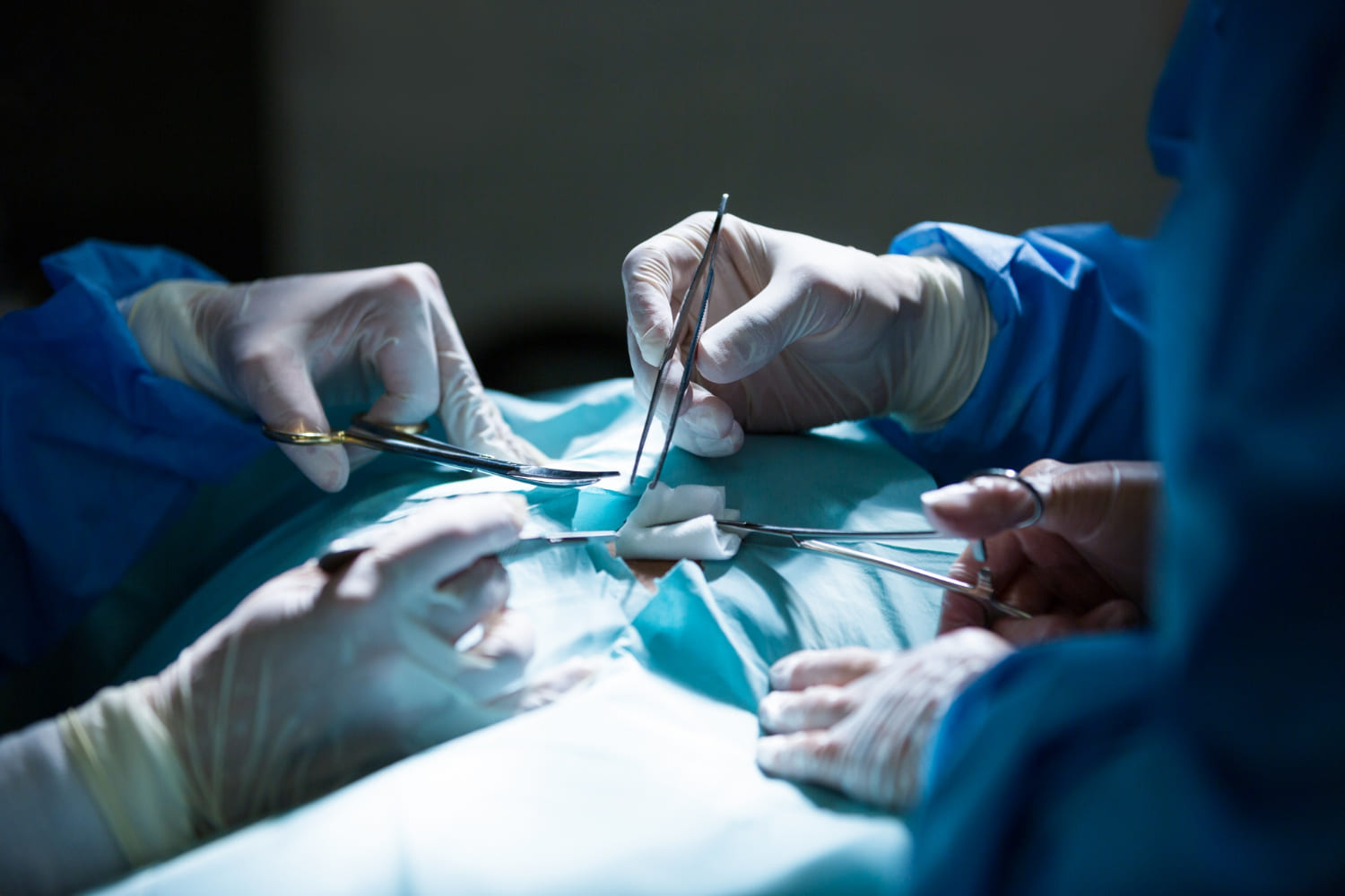 Punción lumbar en CDMX: Diagnóstico preciso con Neurocirugía de vanguardia